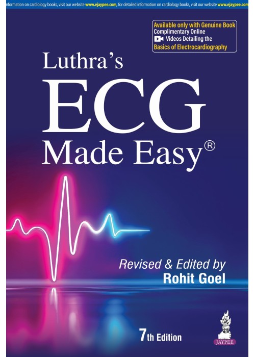 ECG Made Easy